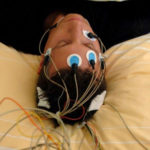 electroencefalograma